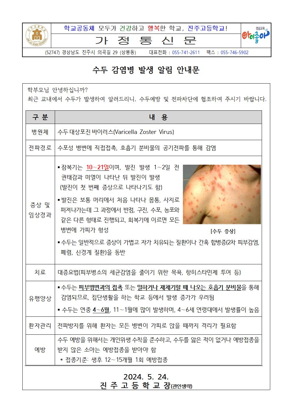 [0524] 수두 감염병 발생 알림 안내문001.jpg